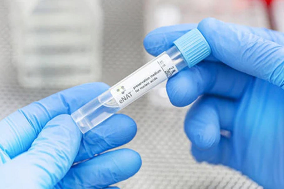 Effectiveness of eNAT® Medium for Long-Term Fecal Microbiome Sample Preservation