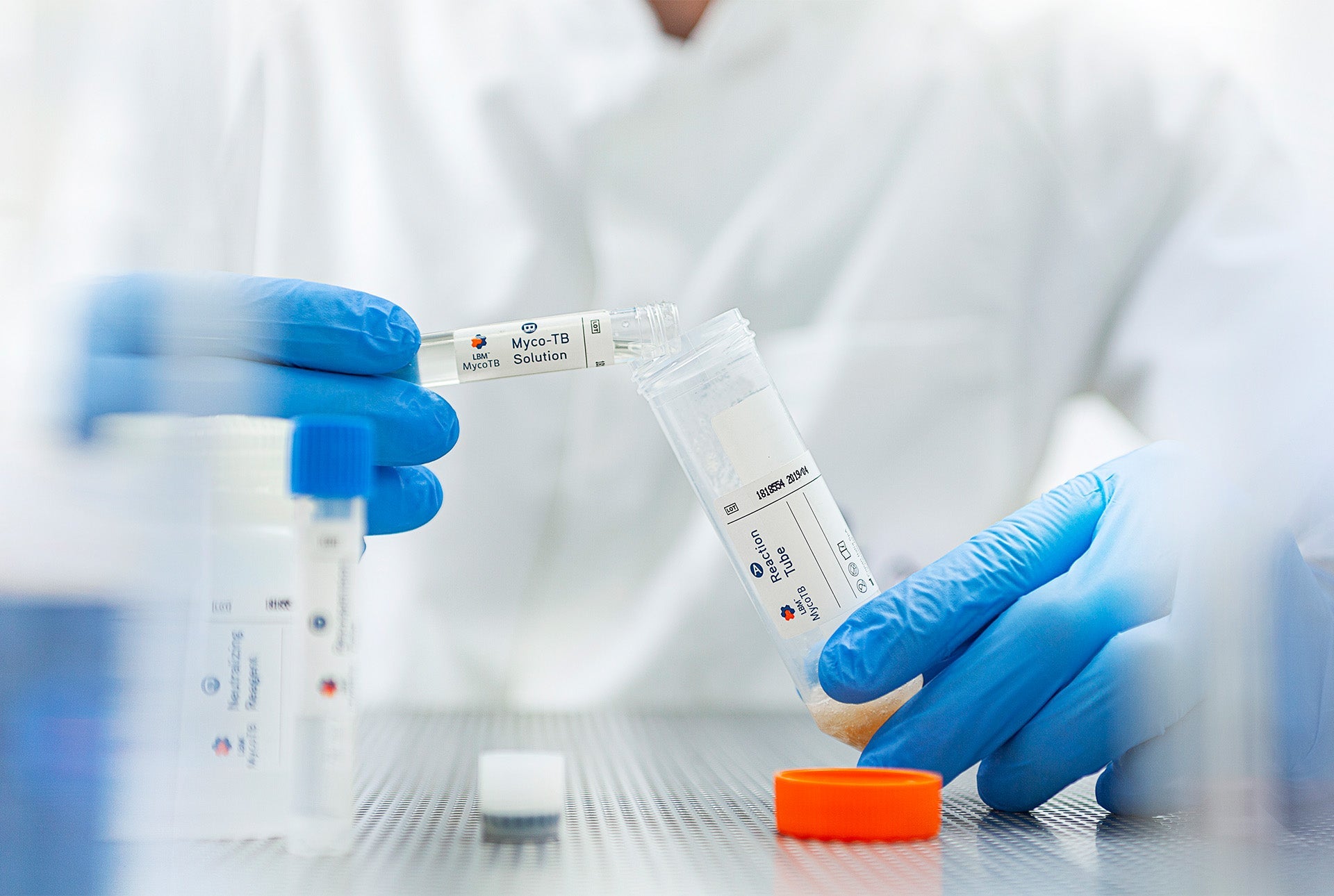 Respiratory Infections: Breathtaking Preanalytics Tools