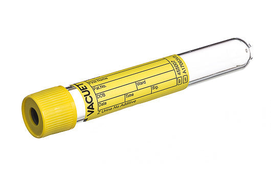 Greiner No Additive Vacuette Urine 10ml - Interpath Services Pty Ltd